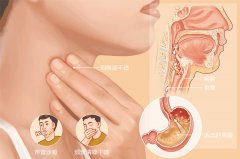 慢性喉炎久不治,咽喉疾病接踵而至-成都耳鼻喉醫院提示