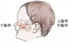 成都看鼻科口碑醫(yī)院_如何自查自己是否患有鼻甲肥大?